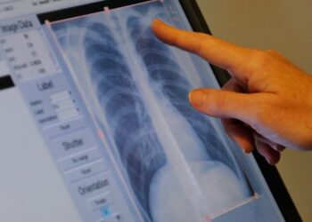 Crisis Sanitaria Por Letal Brote Bacteriano - Vecinos Unidos
